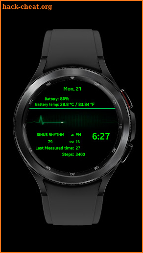 Sinus Rhythm (ECG) - Luxsank screenshot