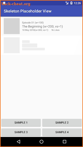 Skeleton Placeholder View - Sample screenshot