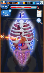 Surgery Master screenshot