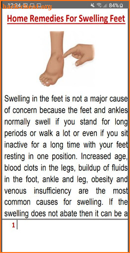 SWOLLEN FEET HOME REMEDIES screenshot