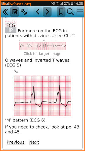 The ECG Made Easy, 8e screenshot