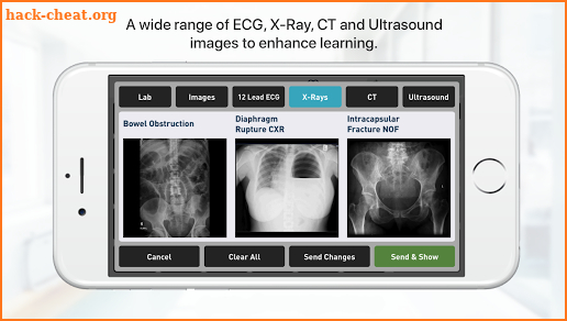 TruMonitor - Simulated Patient Monitor screenshot