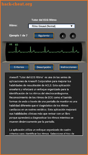 Tutor del ECG Ritmo screenshot