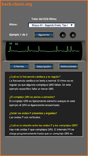 Tutor del ECG Ritmo screenshot