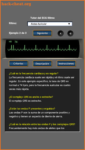 Tutor del ECG Ritmo screenshot