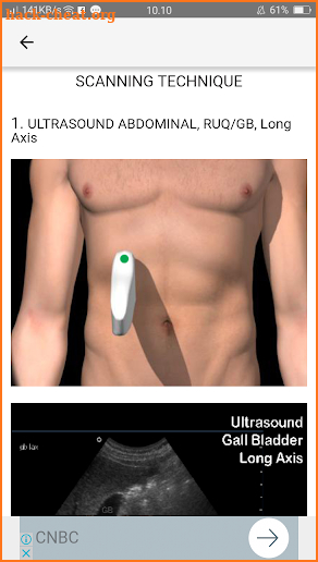 ULTRASOUND GALLBLADDER AND PHATOLOGY screenshot