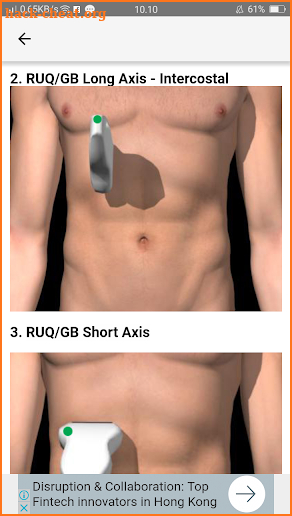 ULTRASOUND GALLBLADDER AND PHATOLOGY screenshot