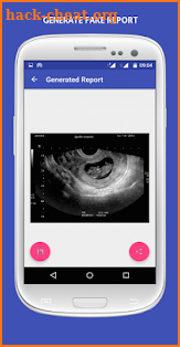 UltraSound Spoof screenshot