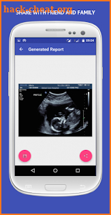 UltraSound Spoof screenshot