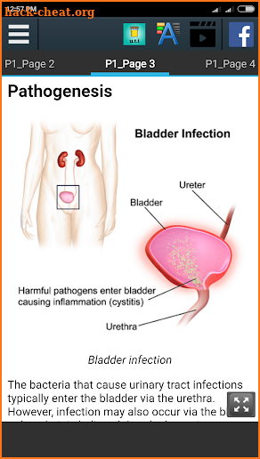 Urinary Tract Infection Info screenshot