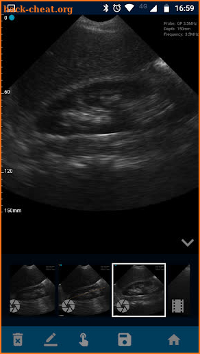 VistaScan Ultrasound App screenshot