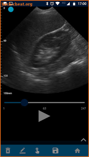 VistaScan Ultrasound App screenshot