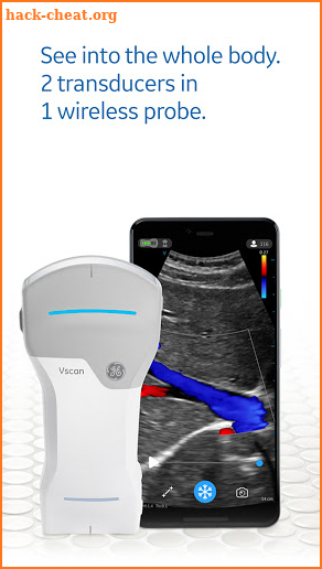 Vscan Air Wireless Ultrasound screenshot