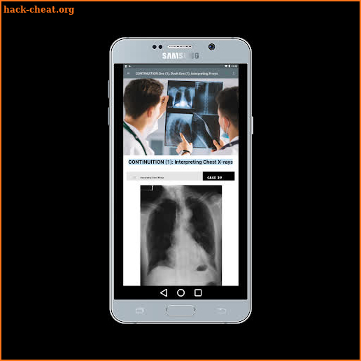 X-ray Interpretation for Medical Use screenshot