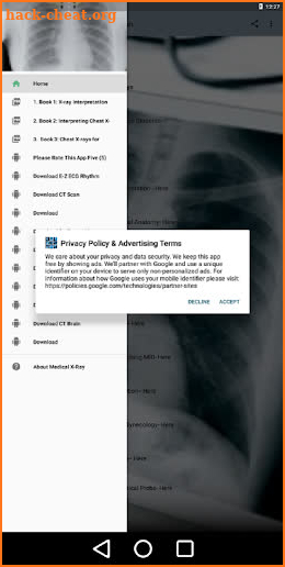 X-Ray -Medical XRay Interpretation with 100+ Cases screenshot