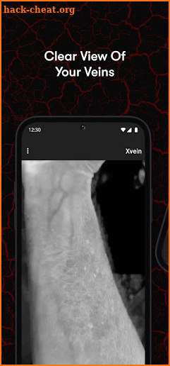 X-Vein screenshot