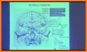 Cochlear implant. Distinguishing sound frequencies related image