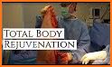 Incredible liposuction related image