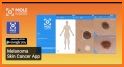 MySkinPal - Skin Cancer App related image