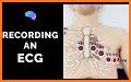 EKG Electrocardiography Exam review  Free App related image