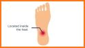 Heel Pain: Causes, Diagnosis, and Treatment related image