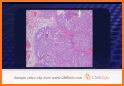 Board Review Series - Pathology related image