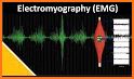 McLean EMG Guide related image