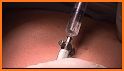 Learn Laparoscopy Free related image