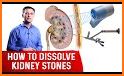 Stone MD — Kidney stones related image