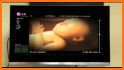 Sonogram Prank related image