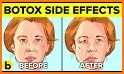 Botox Run! related image