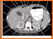 CT Scan Cross Sectional Anatomy related image