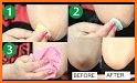 Get Rid Of Dark Knees And Elbows Fast & Naturally related image