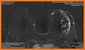 Basic Radiology - SecondLook related image