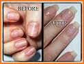 Nailti Gel related image