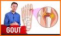 Gout Relief Recipes related image