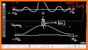 ECG CALC Lite related image