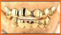 Seattle Gold Grillz related image