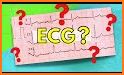 Electrocardiogram ECG Types related image