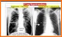 A-Z Chest X-Ray Interpretation related image