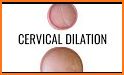 Dilation Body related image