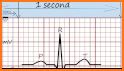 EKG Türkçe Eğitim Uygulaması related image