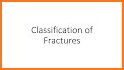 AO/OTA Fracture Classification related image