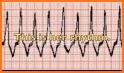 ACLS Sim 2017 related image