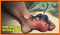 Man Shoes Gout related image