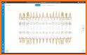 Densor - Dental Charting App related image