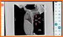 RadMax - Radiography Guide related image