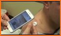 Skin Cancer App - MySkinPal related image