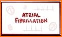 Atrial fibrillation related image