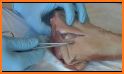 Basic Surgical Techniques related image